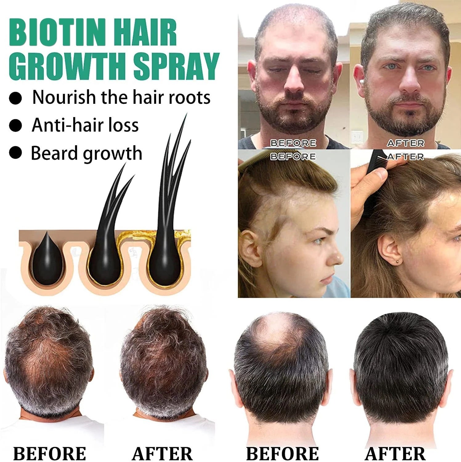 HairRevive™