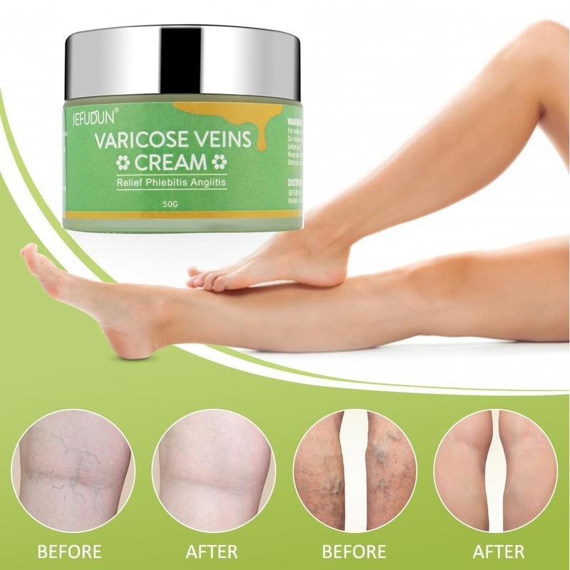Vein Cream Red Blood Streaks Repai